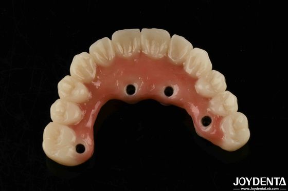 購入 迅速乾燥 チタンバー アクリル歯 完成 透明 アクリル歯 歯科用品 オンライン製造