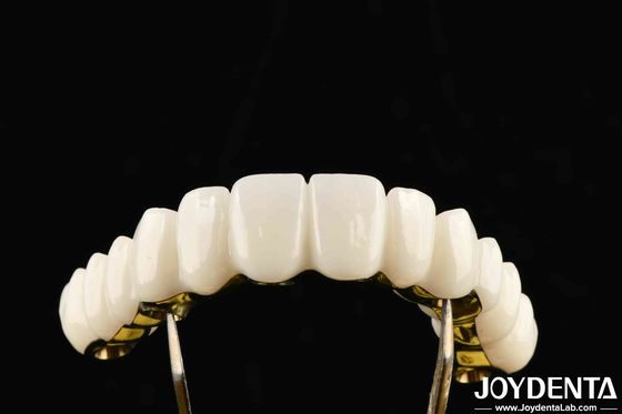 購入 パーソナル化歯科ソリューションのための優れた強度 オンライン製造