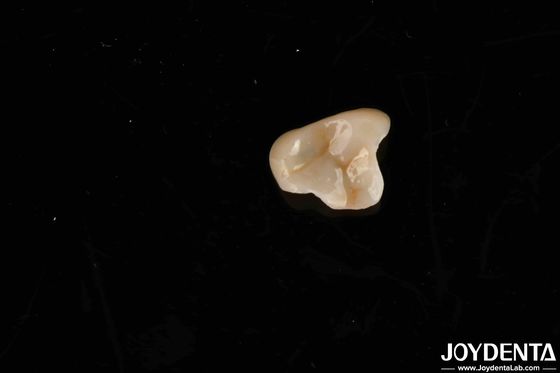 購入 無毒なE-MAX素材 最終ソリューション エマックスインレイ 生物適合性基準のためのインレイ オンライン製造