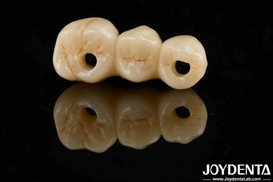 購入 高美学 高屈折強度 1000 MPa 標準のためのフルジルコニア オンライン製造