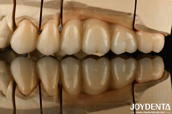 購入 ホワイトフルジルコニア 熱衝撃に強い耐性 高強度 オンライン製造