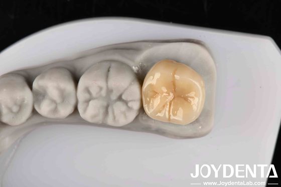 購入 熱ショックと腐食に対する高耐性 優れた化学的安定性のあるジルコニア オンライン製造