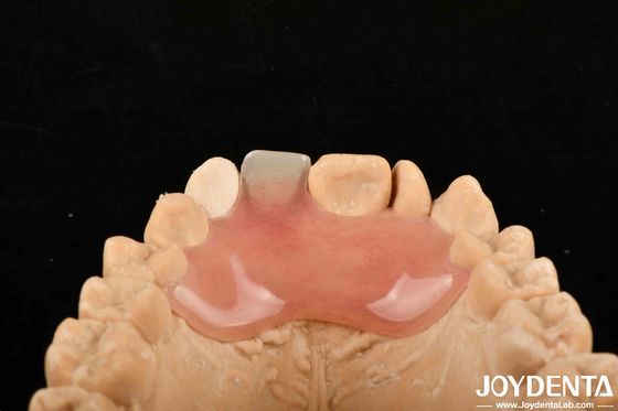購入 高密度 弾性 柔軟性 多種多様な製造プロセス用 歯入れ仕上げ オンライン製造
