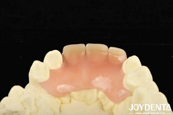 購入 軽量 で 多様 な 製品 を 用い て,歯科医院 に 革命 的 な 変化 を もたらす オンライン製造