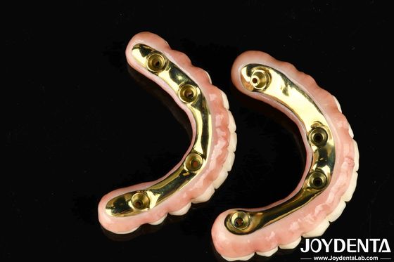 購入 耐久性と生物互換性の高いチバージルコニアハイブリッドブリッジ オンライン製造