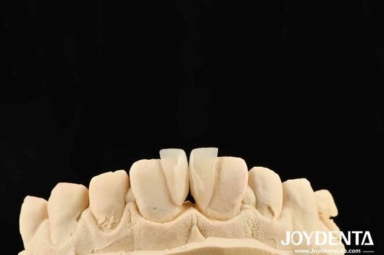 購入 高耐久性 マイクロフェニエ 0.2mm 厚さ そして信頼性の高い性能 オンライン製造