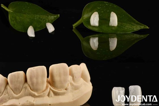 購入 高耐久性 超薄型 マイクロフェニヤー 厚さ 0.2mm 天然木 オンライン製造