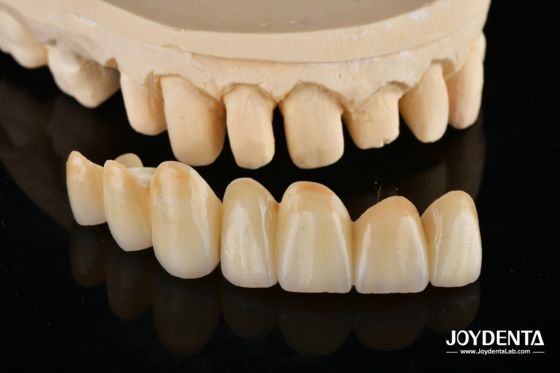 購入 Unveil True Biomimicry: Introducing Our Multi-Layered Zirconia Aesthetic Bridge オンライン製造