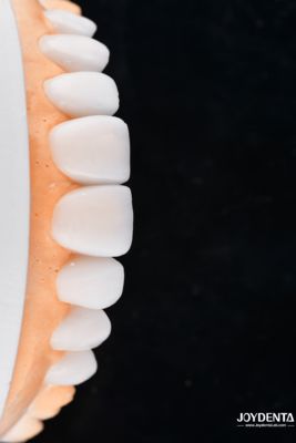 購入 Enhance Case Acceptance & Patient Communication with Our Diagnostic Wax-Up Service オンライン製造