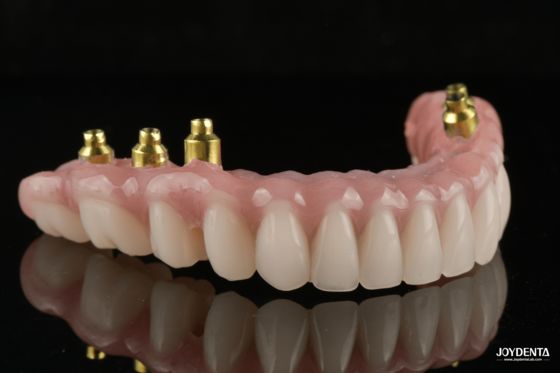 購入 The Strength of Titanium, The Art of Natural Aesthetics. オンライン製造