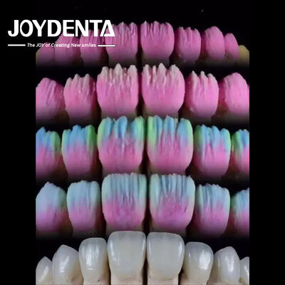 購入 The Joydenta Ceramic Veneer Process オンライン製造