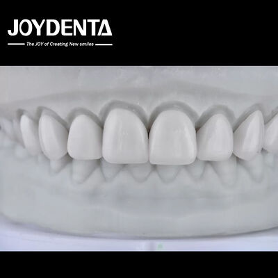 購入 Visualize the Result, Secure the Case: Our Diagnostic Wax-Up Service オンライン製造