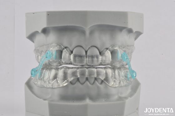 シリコン アンチ 打つ 口蓋 打つ 歯科 器具 快適