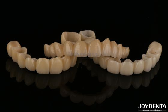 自然に見たポルセラン層ジルコニアブリッジ 耐磨性 高生物互換性