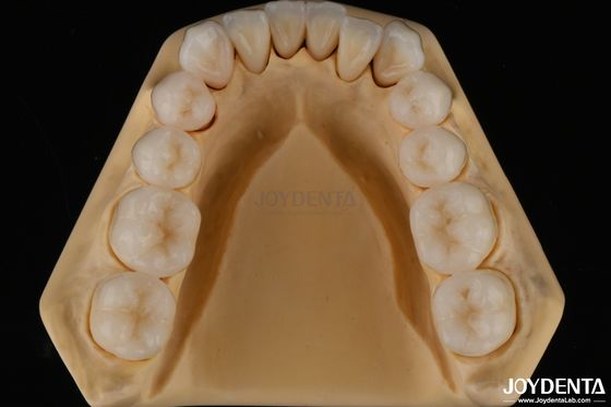 3D多層歯科 完全ジルコニア 破裂耐性 自然歯構造