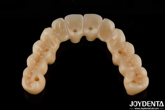 高柔軟性 ツルコニアハイブリッドブリッジ チタンベース 高美学