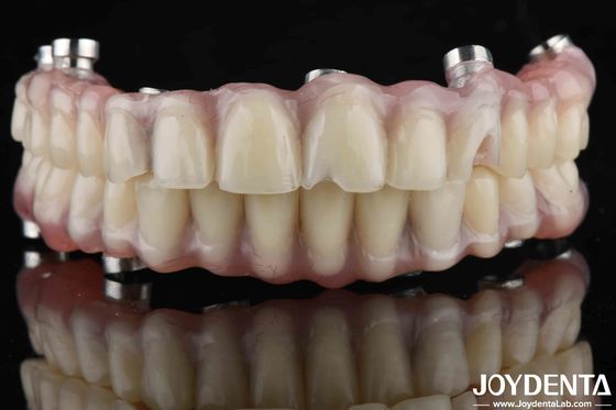 耐磨性が高いために自然に見える歯科研究室アクリル歯の仕上げ