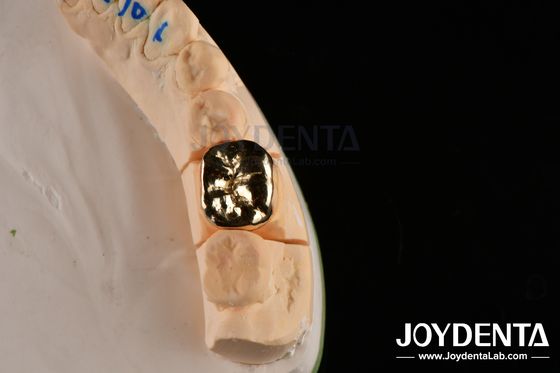 歯磨き耐性 歯磨き用ワックス 鋳造 口腔クリニック修理用