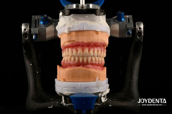 軽量 コンフォート フィット アクリル 歯科 歯科 パーソナライゼーション