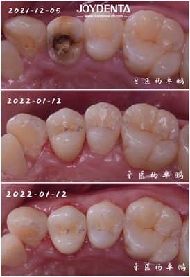正確 に 適した 歯 器 器 器 器 器 器 器 器 器 器 器 器 器 器 器 器 器 器 器 器 器 器 器 器 器 器 器 器 器