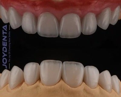 高透明性フェルドスパシックフェニール 強い粘着性のある化粧品ポルセランフェニール