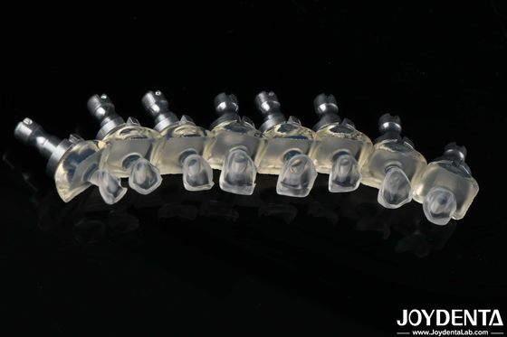 高透明ガラス ポーセラン 歯のフロニヤ 高強度 0.3-0.8mm 厚さ