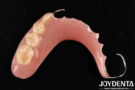 安定した口腔構造のための技術開発 歯科応用における歯の仕上げを設定する