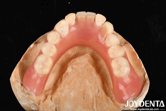 軽量 良質 生物互換性 アクリル歯科 医療機器のパーソナライズされたパーソナライゼーション