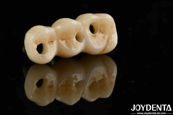 優れた生物互換性と高強度 リアルな色 完全なジルコニア B2B調達ソリューション