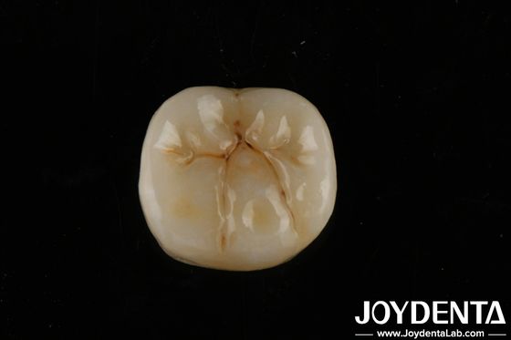 高透明性 層付き 完全ジルコニア 生物互換性 折りたたみ強さ 800 MPa