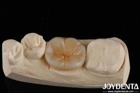 折りたたみ強さ 800 MPa と 8 MPa·m1/2 折りたたみ強さ 多層のフルジルコニア 強度アプリケーション