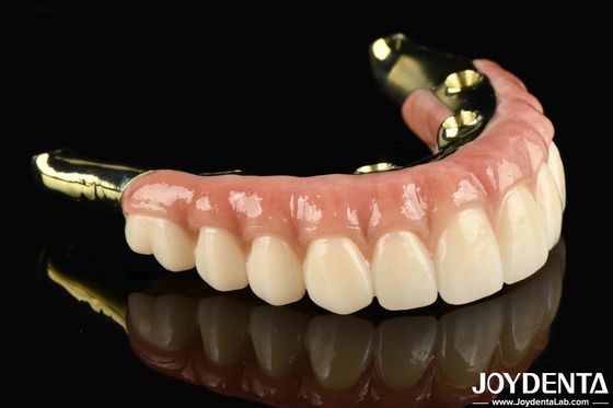 歯が欠けている歯にさよならを言ってください 自然で耐久性のあるジルコニア