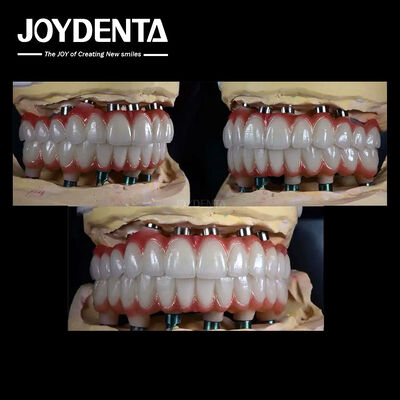 10mm チタン 多歯植入 歯の修復のための粗い表面