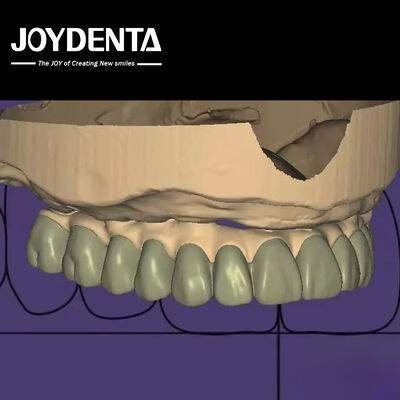 個別設計 デジタル診断 ワックスアップ ラボソフトウェア シームレスな統合