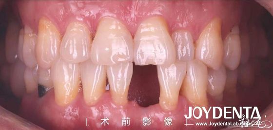 名前